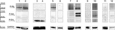 The roles of phosphorylation of signaling proteins in the prognosis of acute myeloid leukemia